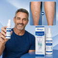 Varicose Veins Relief Spray Vitality Supplement