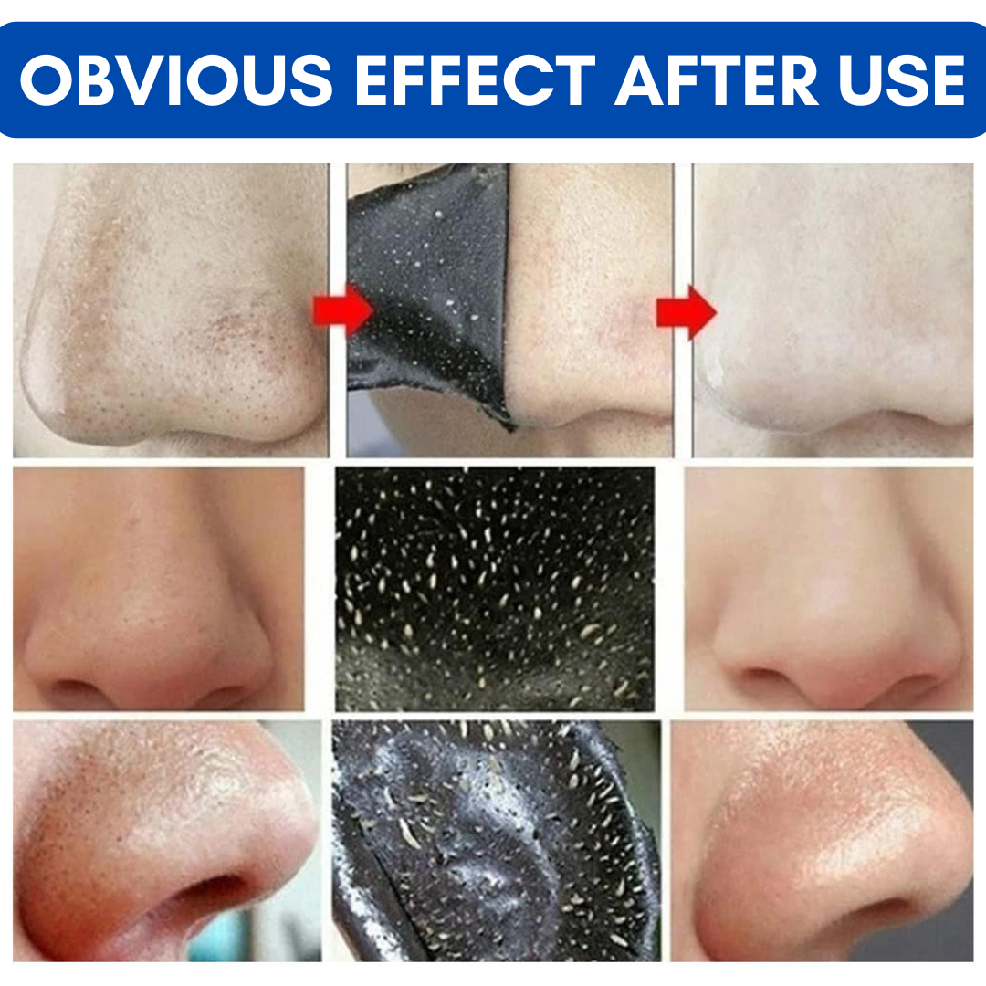 Deep Cleansing Nose Strips Pore Cleanser