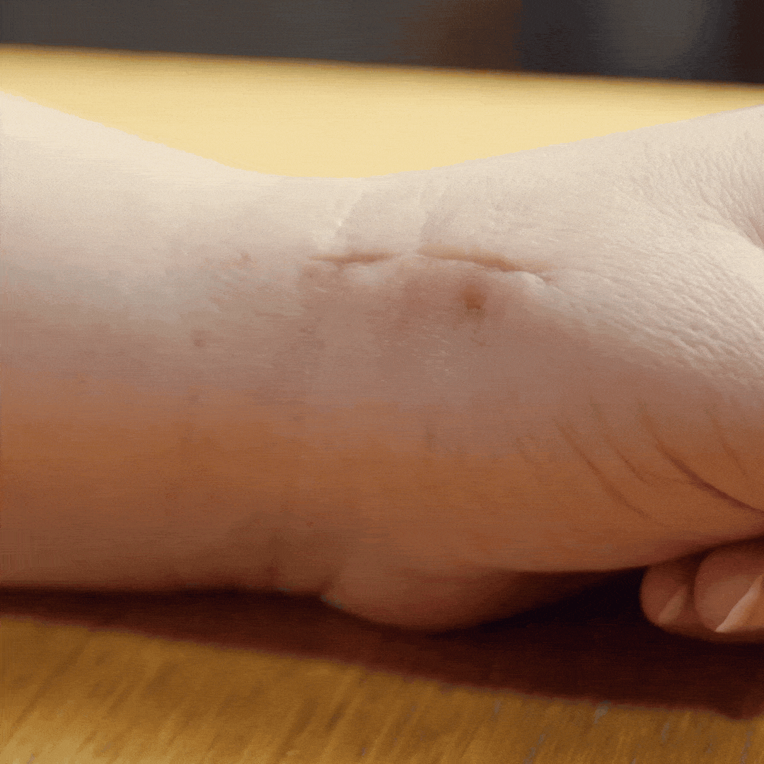 Silicone Scar Patch Skin Repair Supplement